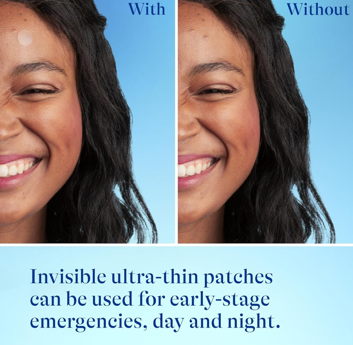 Differin Acne Pimple Patches 36 Count