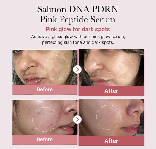 medicube Salmon DNA PDRN Pink Peptide Serum