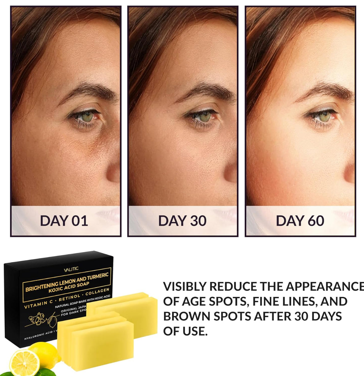 VALITIC Brightening Lemon & Turmeric Kojic Acid Soap with Vitamin C, Retinol, Collagen - 5 Pack