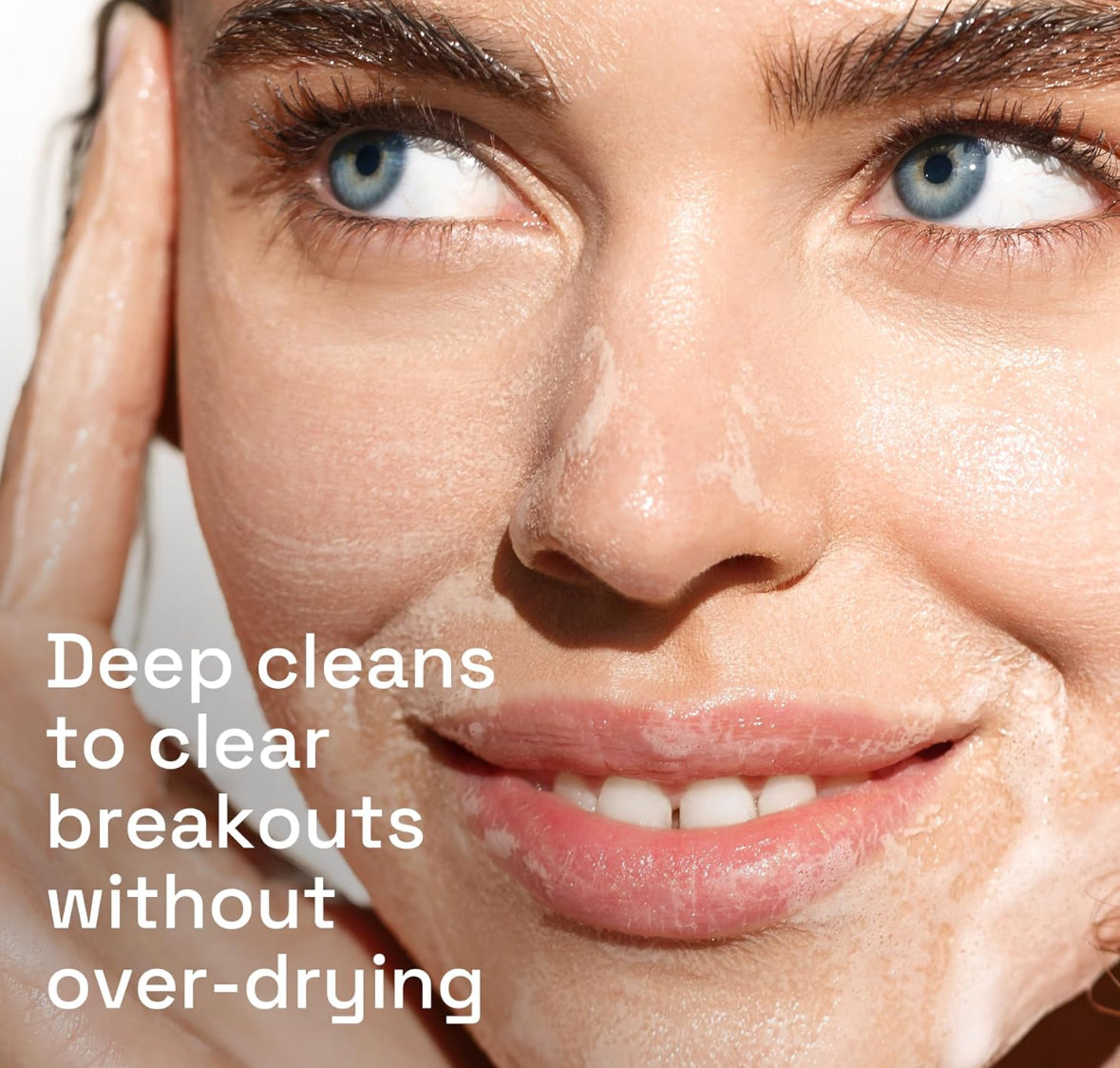 Cetaphil Acne Face Wash Cream Cleanser 2% Salicylic Acid