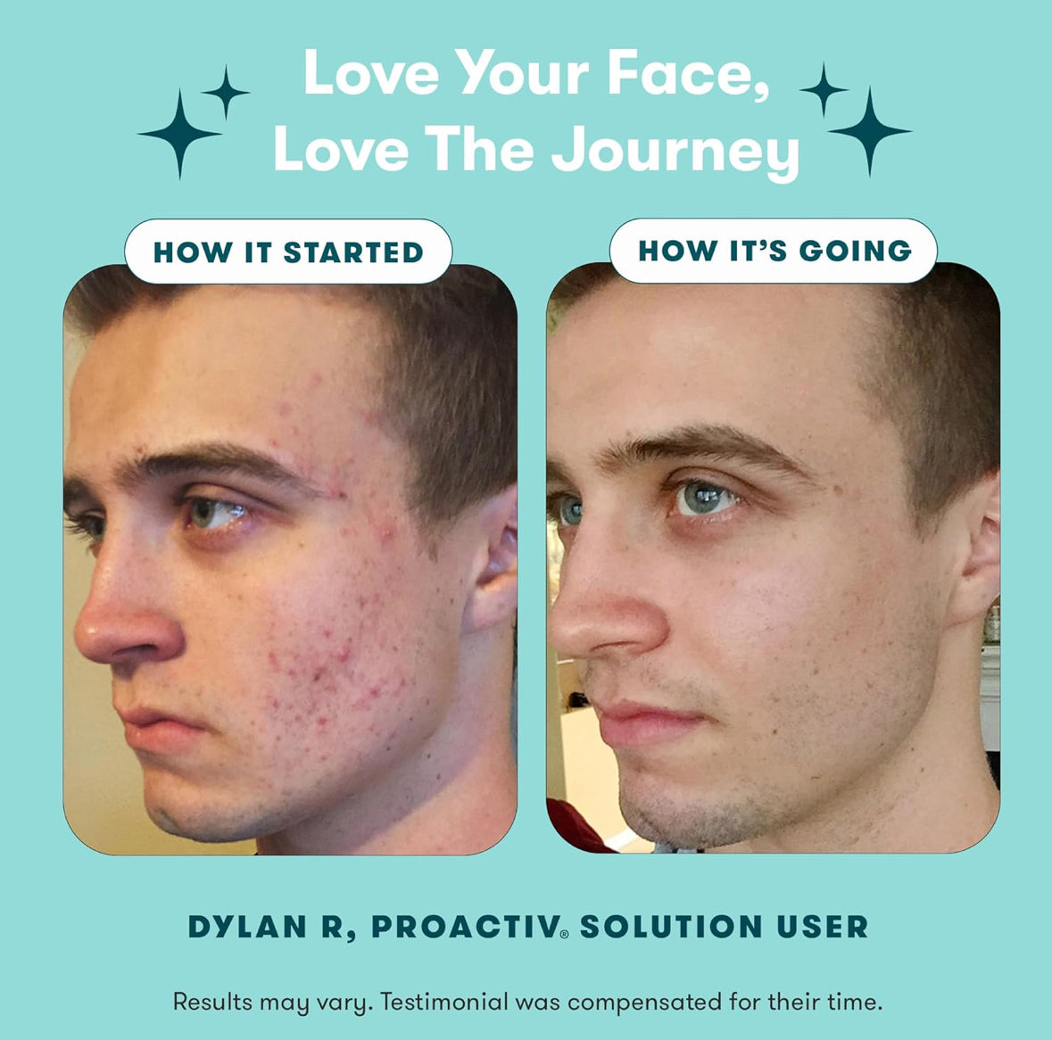 Proactiv 3 Step Acne Treatment - 30 Day