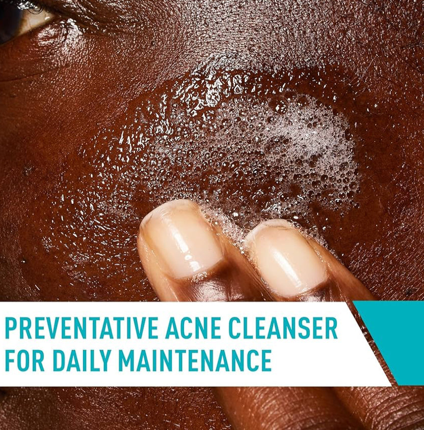 CeraVe Acne Treatment Face Wash