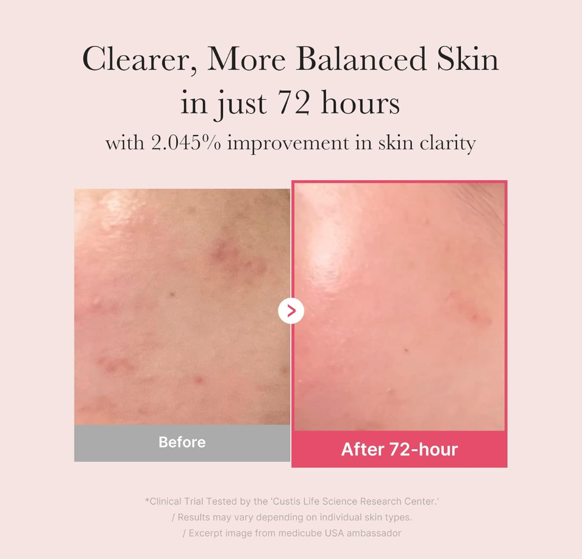 medicube TXA+Niacinamide 15% Glow Facial Serum for After Spot Care