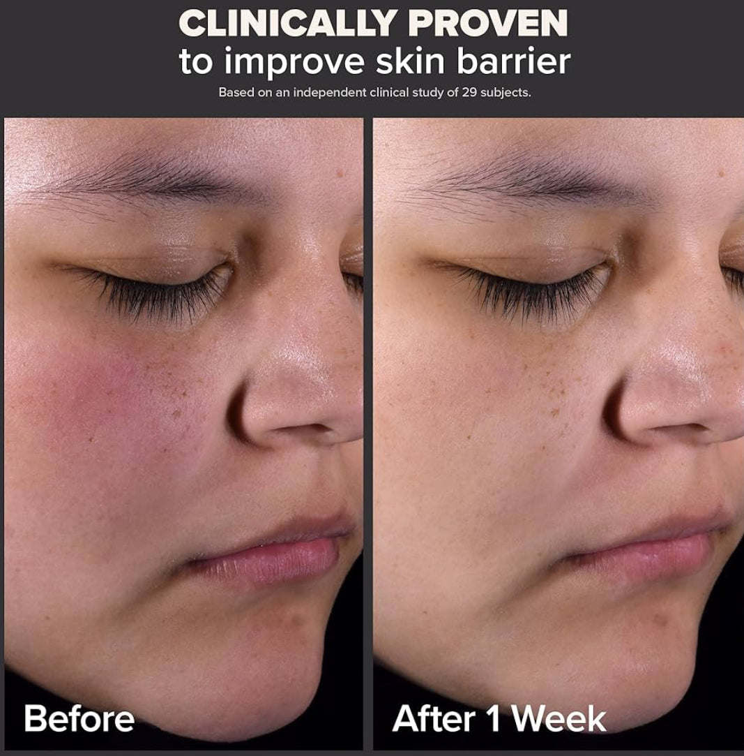 Paula's Choice Skin Perfecting 2% BHA Liquid Salicylic Acid Exfoliant-Facial Exfoliant