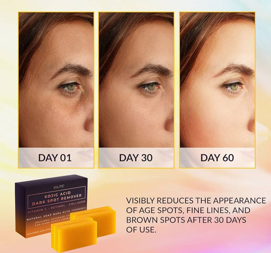 Valitic Kojic Acid Dark Spot Remover Soap Bar with Vitamin C, Retinol, Collagen, Turmeric