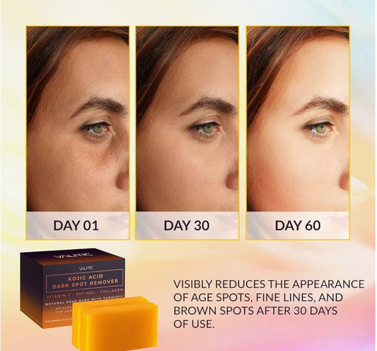VALITIC Kojic Acid Dark Spot Remover Soap Bars with Vitamin C, Retinol, Collagen, Turmeric
