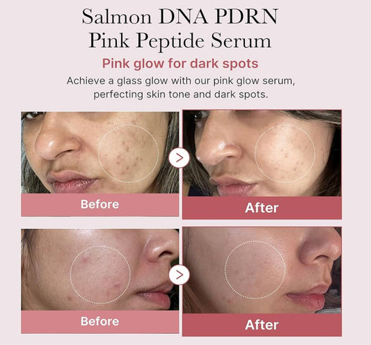 Medicube Salmon DNA PDRN Pink Peptide Serum
