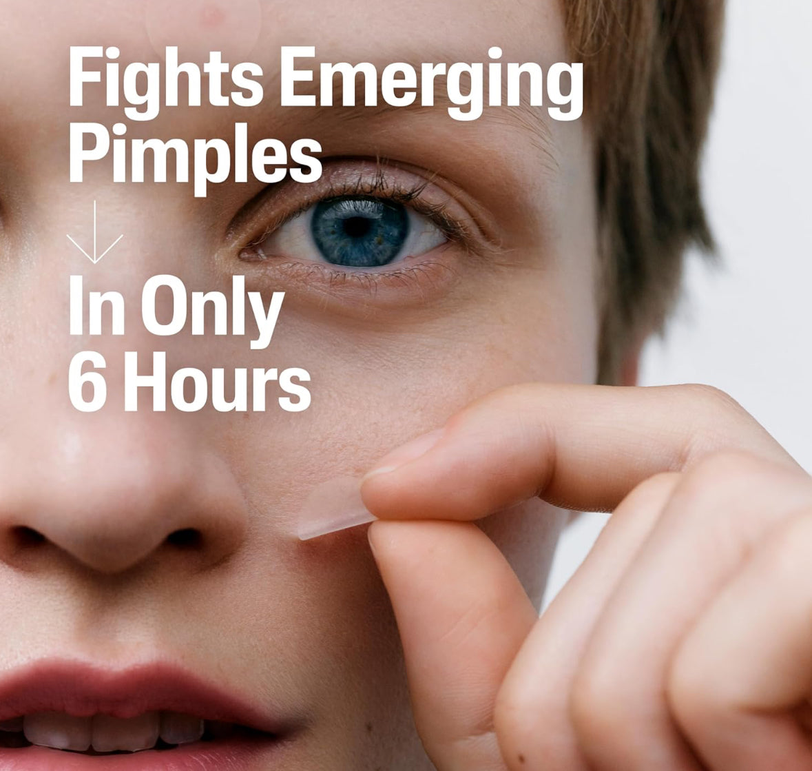 Cetaphil Acne Pimple Spot Patches