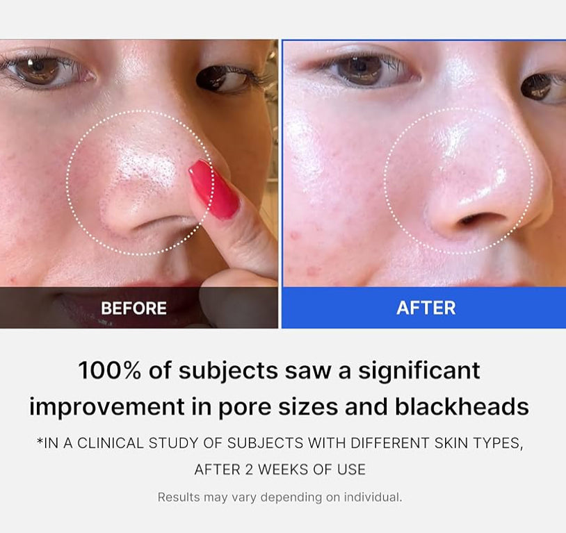 Medicube Zero Pore Pads 2.0