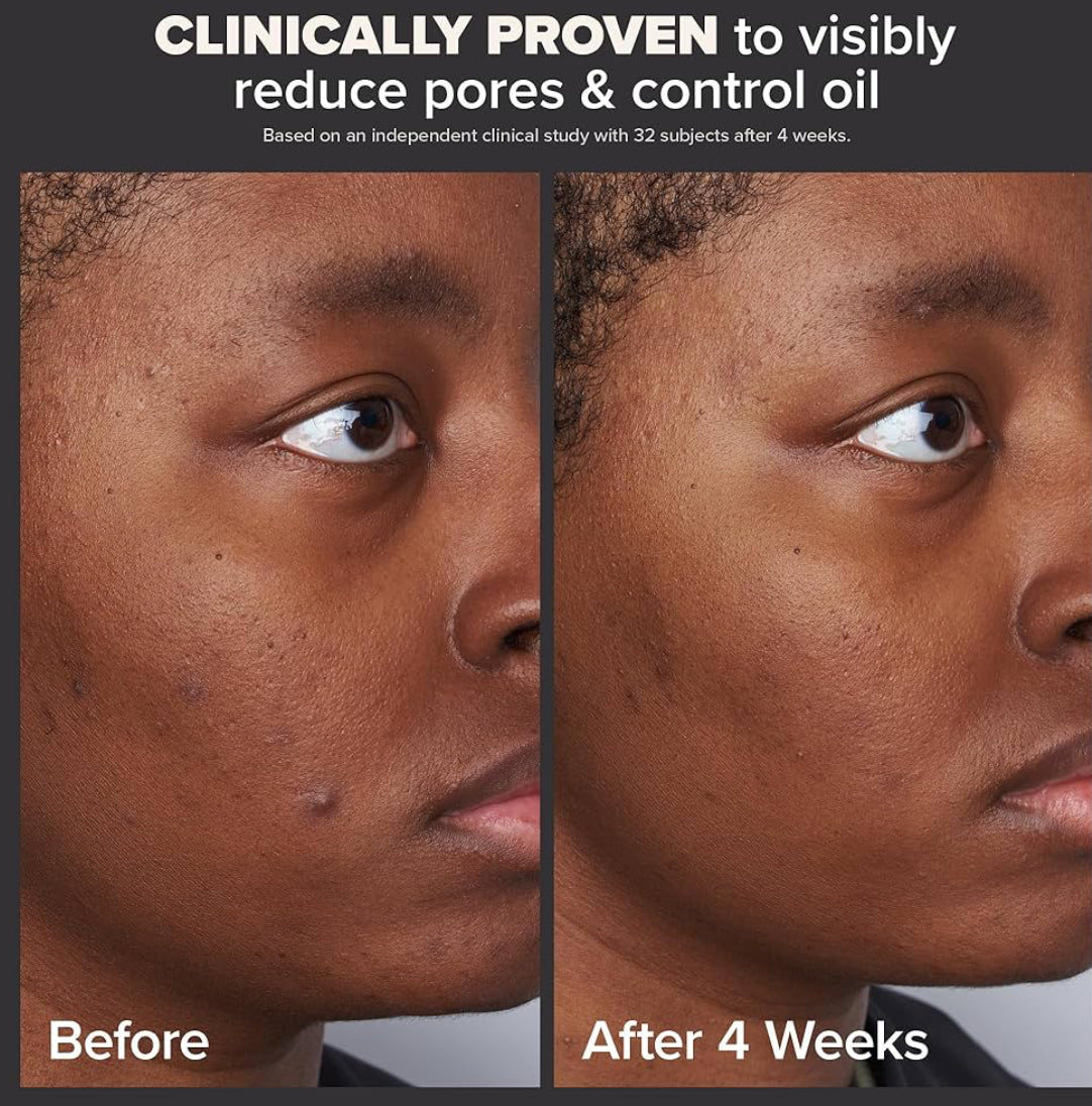 Paula's Choice Skin Perfecting 2% BHA Liquid Salicylic Acid Exfoliant-Facial Exfoliant