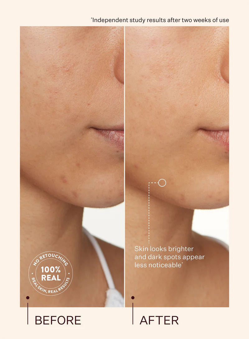 Peach & Lily Transparen-C Pro Spot Acne Treatment