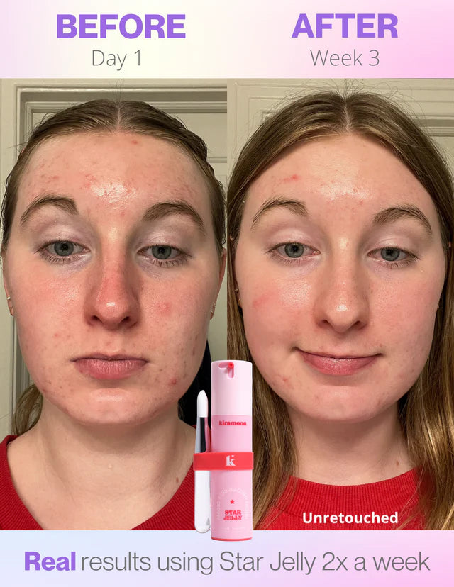 Kiramoon Star Jelly Mask