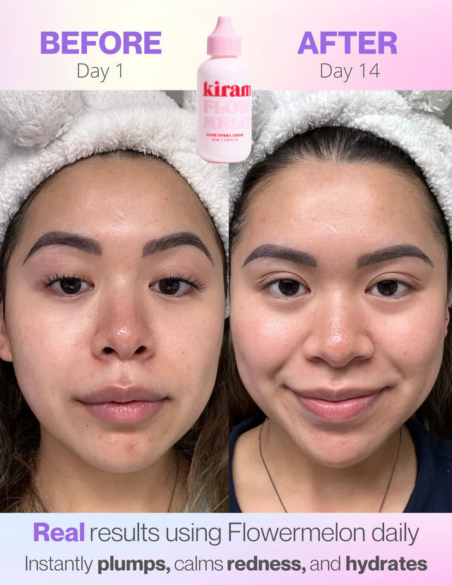 Kiramoon Flowermelon Serum